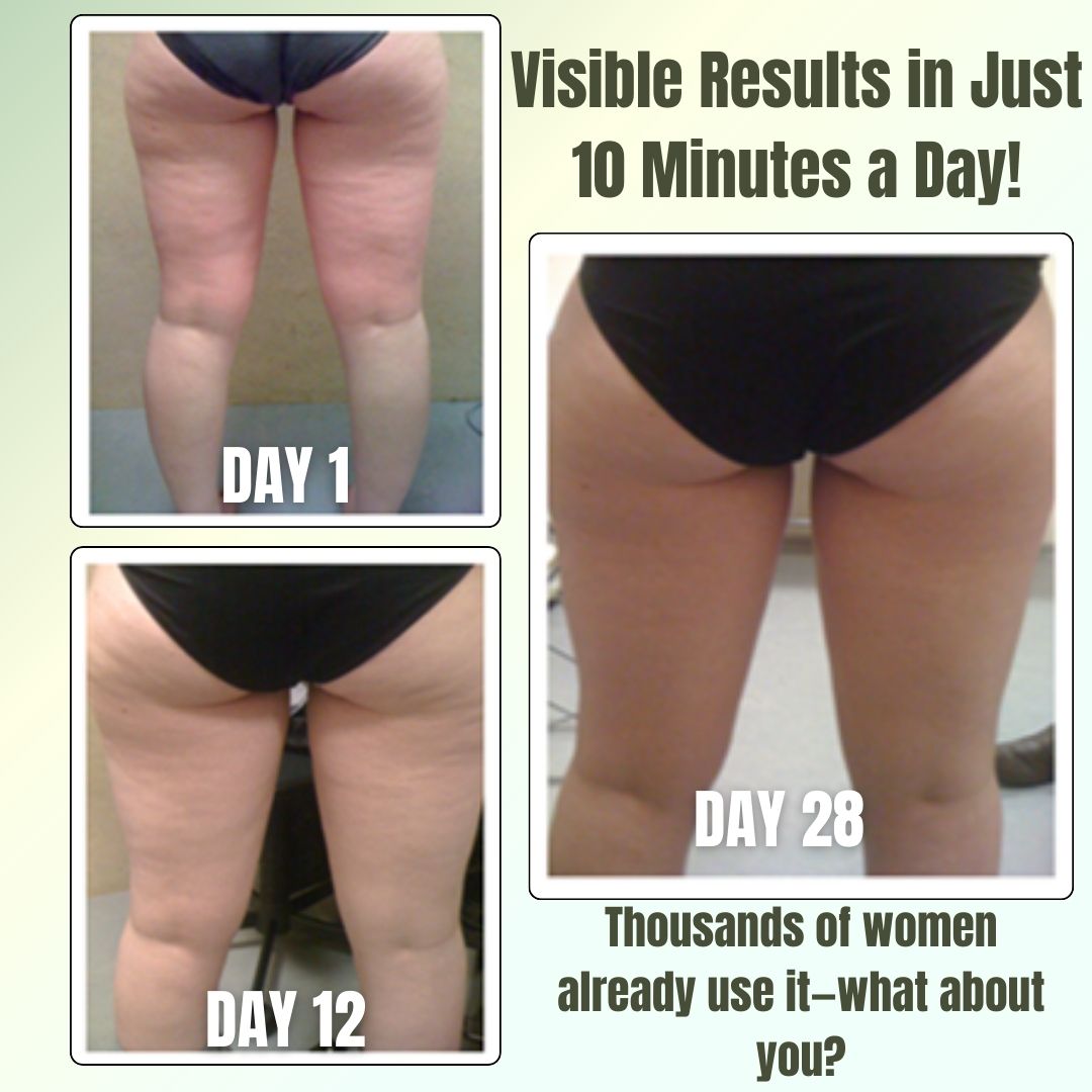 SlimLeggys™–Smooth Away Cellulite & Fluid Retention!